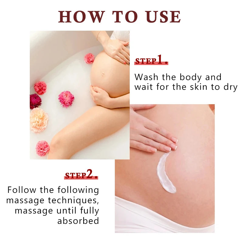 Stretch Mark Vanishing Cream Remove Body Buttock Breast Marks Effective Treatment Repair Maternity Loose Firming Skin Care 50g